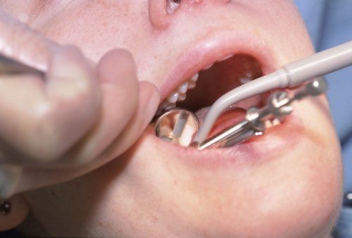 Odontopediatría en Coslada Odontopediatría en Coslada
