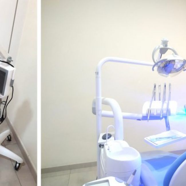 Blanqueamiento dental combinado