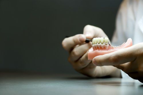 Prótesis dental Prótesis dental