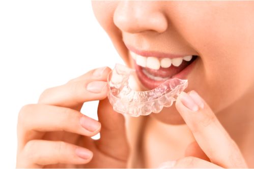 Férula de descarga en Coslada   Clínica Dental El Parque